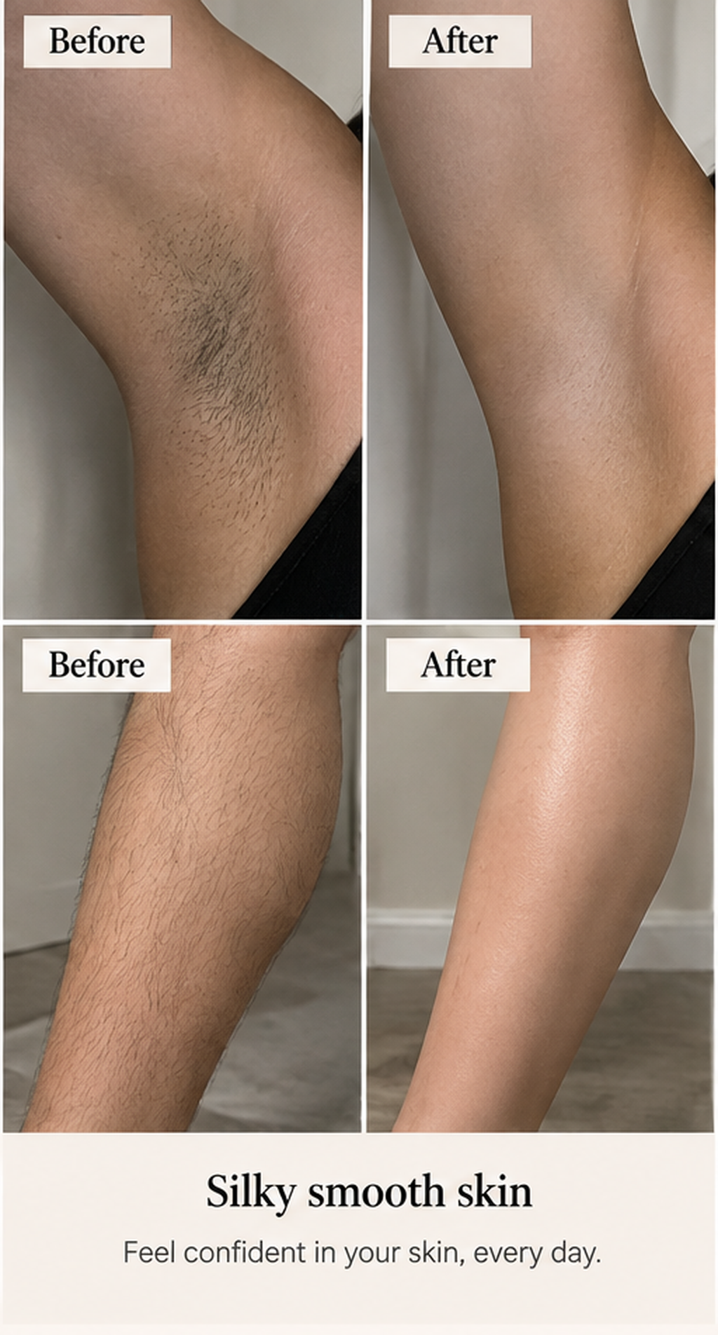 Illustrative hair removal before and after visual