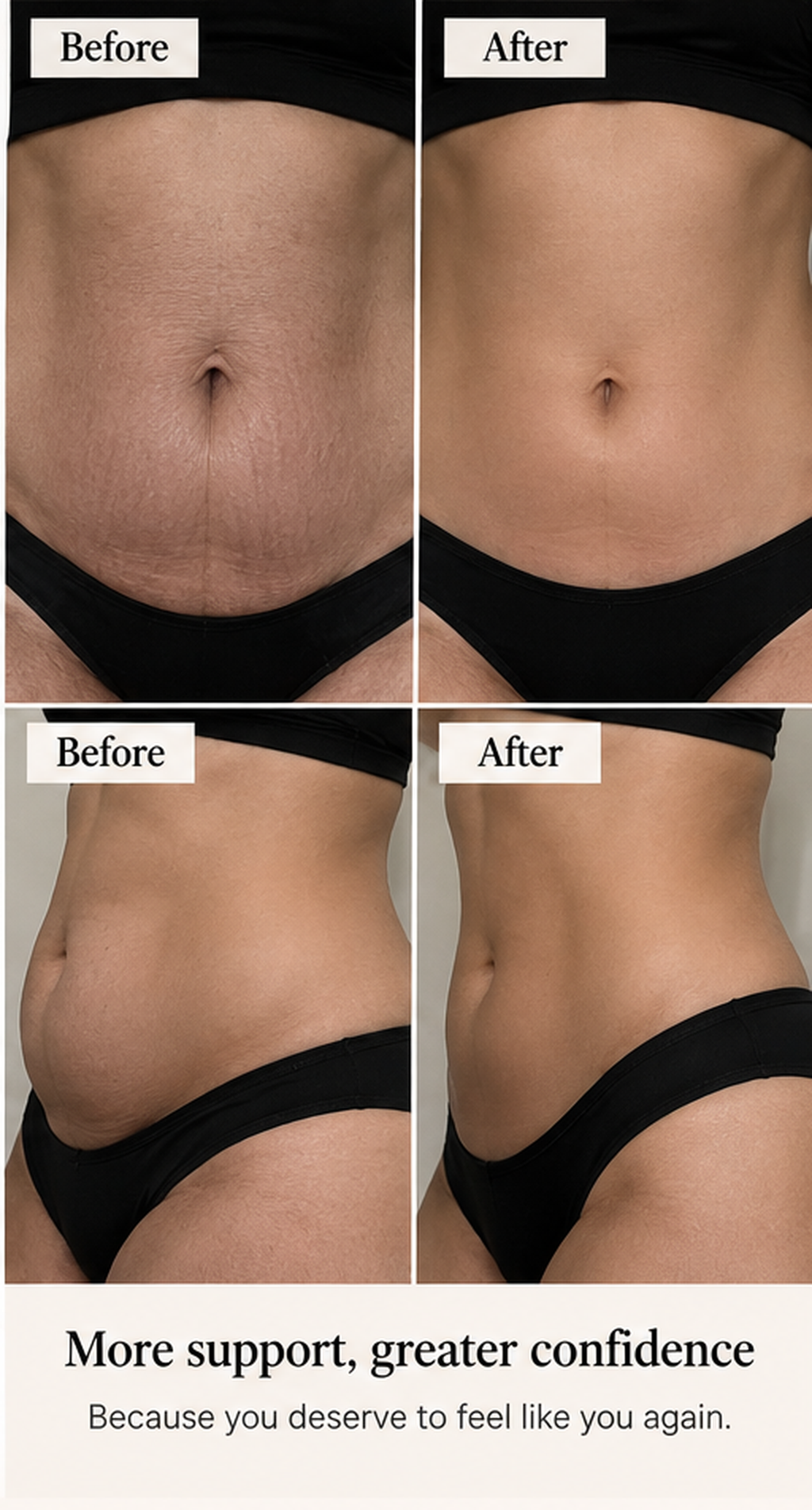 Illustrative postpartum before and after visual